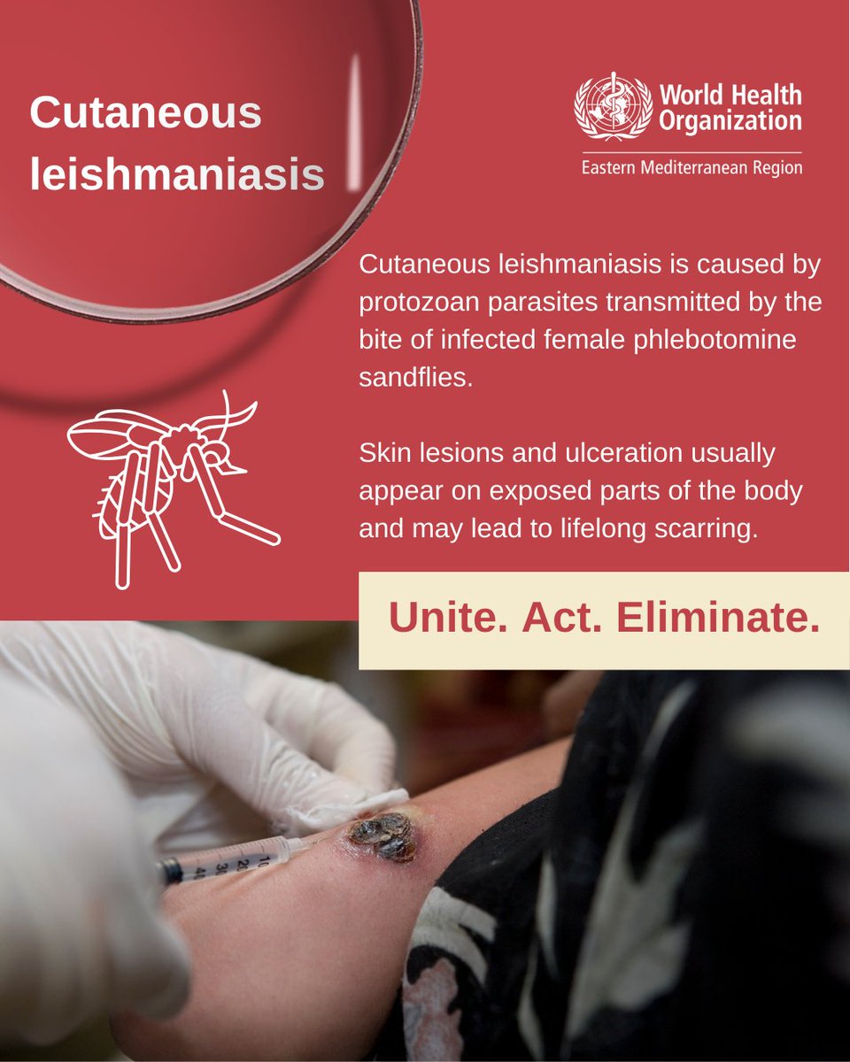 WHO Regional Office for the Eastern Mediterranean (@whoemro) on Twitter photo The <a href="/WHOEMRO/">WHO Regional Office for the Eastern Mediterranean</a> Region has the highest global burden of cutaneous leishmaniasis, accounting for over 80% of the cases reported worldwide in 2023.
Early diagnosis and effective prompt treatment are essential to:
🟣reduce prevalence
🟣reduce disease transmission & monitor its spread The <a href="/WHOEMRO/">WHO Regional Office for the Eastern Mediterranean</a> Region has the highest global burden of cutaneous leishmaniasis, accounting for over 80% of the cases reported worldwide in 2023.
Early diagnosis and effective prompt treatment are essential to:
🟣reduce prevalence
🟣reduce disease transmission & monitor its spread