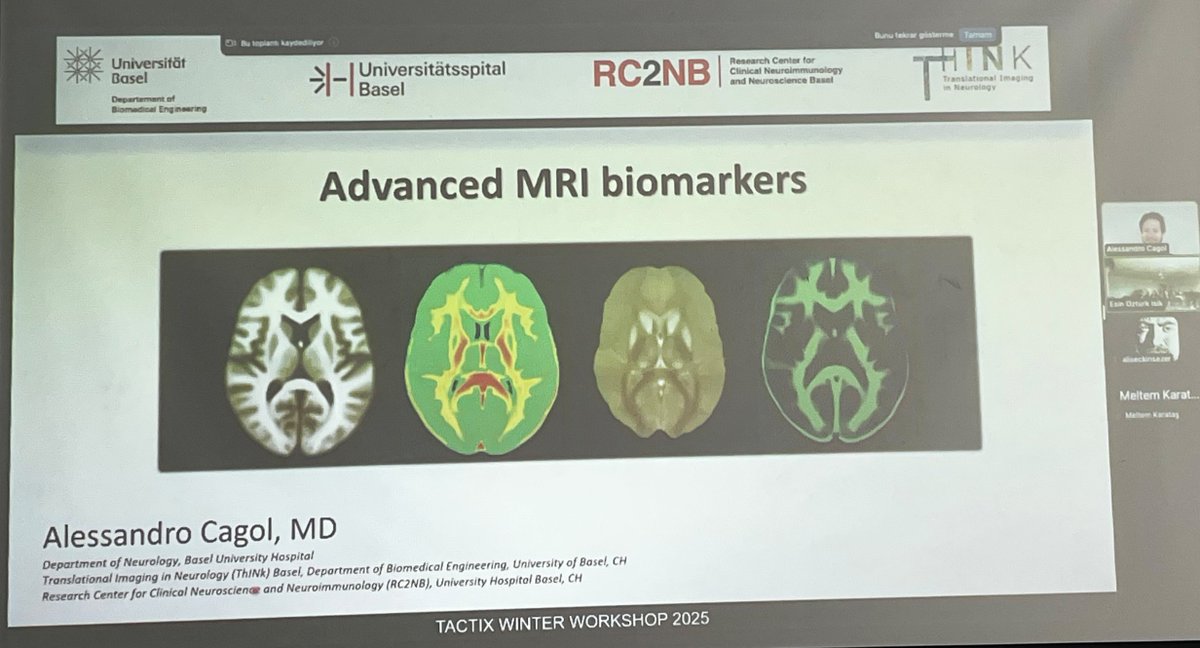 TACTIX_Twinning's tweet photo. This time last week, we were in the midst of the #TACTIX Winter Workshop 2025, going full speed! 🚀 Moments from the final day, featuring the seminars by David van Nederpelt and Alessandro Cagol. #ComputationalMRI #MSresearch #Winning #EUfunded https://t.co/jHHOhcCMN7