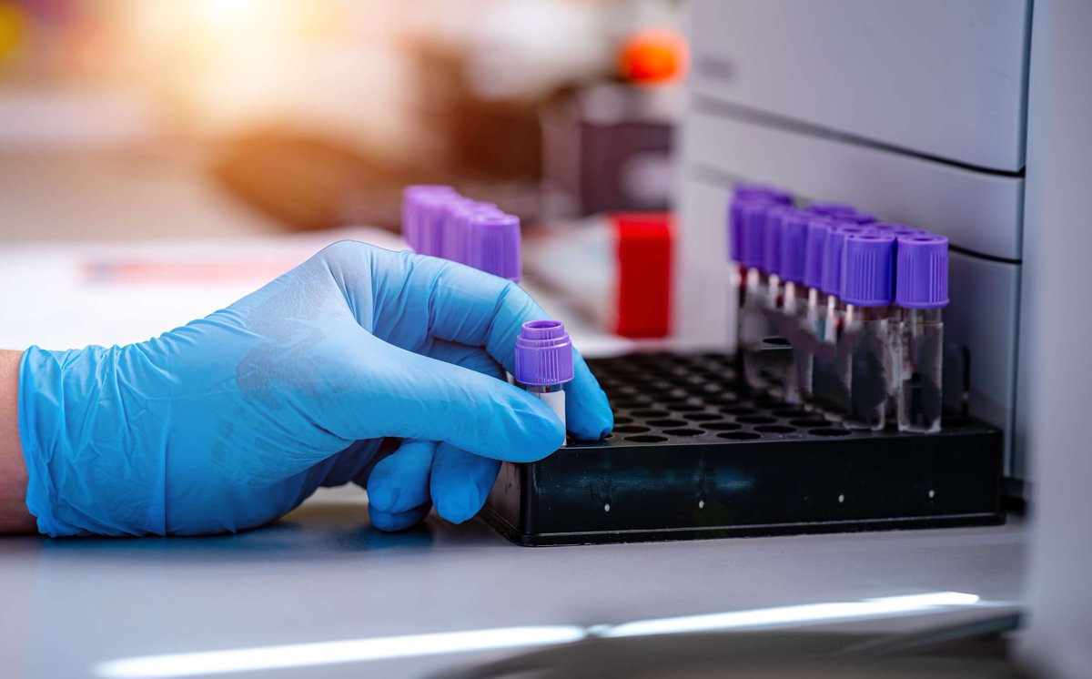 ASI_lab's tweet image. Did you know that we provide therapeutic #drugmonitoring services? 

We specialise in testing:

💊 Antipsychotic drugs, including clozapine
👀 Psychotropic drugs
🥼 Cardiac drugs, specifically flecainide

Contact us to discuss your requirements: ow.ly/uNSg50PEpQI