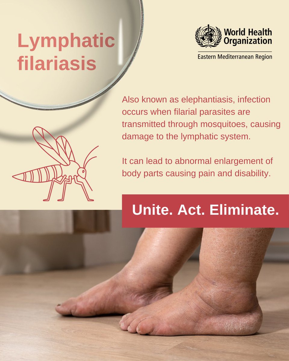 WHOEMRO's tweet photo. Lymphatic filariasis is an infection that can lead to enlargement of body parts causing pain and disability.

It can be:

1⃣asymptomatic: having no external signs of infection
2⃣chronic: causing tissue swelling or thickening
3⃣acute: causing skin and lymph node inflammation

🧵 https://t.co/TwSmyacbRr