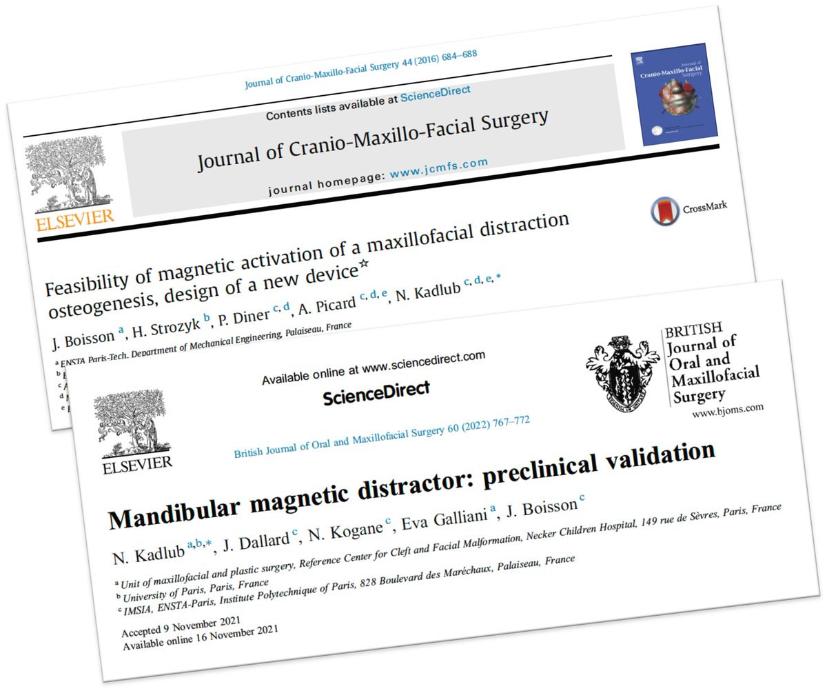 Les Pr <a href="/natachakadlub/">Kadlub</a> et Jean Boisson ont reçu le Prix 2024 🏆 de <a href="/LesGCasseesUBFT/">Les Gueules Cassées</a> pour le distracteur magnétique DOGMA. Bravo 👏🏼
#maladiesrares #gueulescassees #MAFACE
👉🏼 bit.ly/40TrGMA