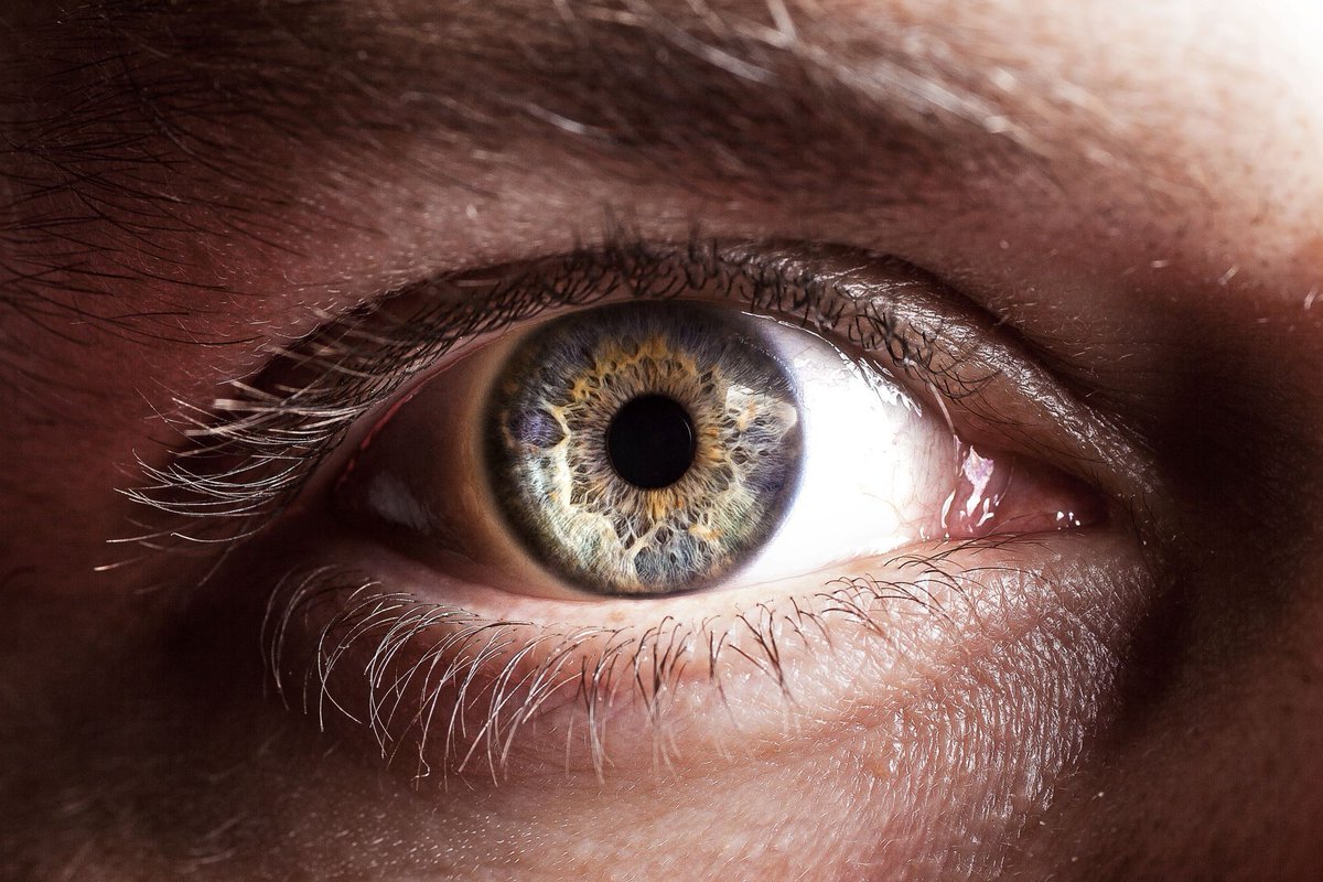 NASS (@nassexercise) on Twitter photo Do you work in #ophthalmology? Do you screen your patients for #backpain? Find out from @moorfields what role you can play in reducing the time to diagnosis in #axialSpA #AxSpA #AxialSpondyloarthritis via <a href="/Eye_Journal/">Eye Journal</a> (paywall exists) buff.ly/40zHXVD Do you work in #ophthalmology? Do you screen your patients for #backpain? Find out from @moorfields what role you can play in reducing the time to diagnosis in #axialSpA #AxSpA #AxialSpondyloarthritis via <a href="/Eye_Journal/">Eye Journal</a> (paywall exists) buff.ly/40zHXVD