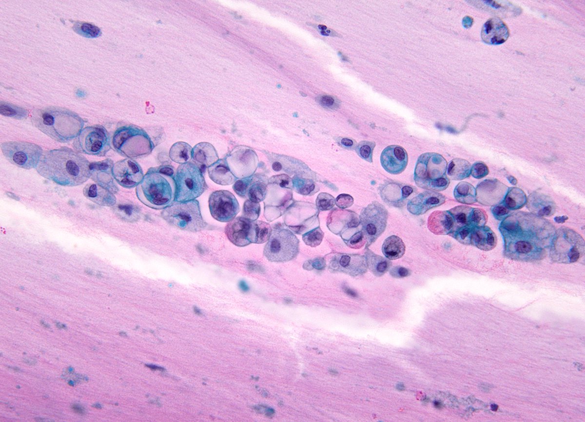 Syed Z. Ali tweet media