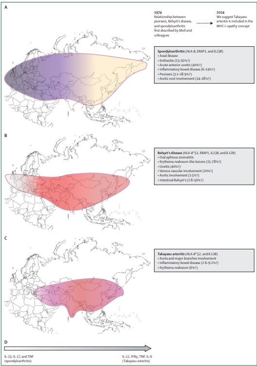 The Lancet Rheumatology (@thelancetrheum) on Twitter photo NEW Personal View—Takayasu arteritis: a geographically distant but immunologically proximal MHC-I-opathy thelancet.com/journals/lanrh… <a href="/keremabacar/">Kerem ABACAR</a> <a href="/HanerDireskenel/">Haner Direskeneli</a> NEW Personal View—Takayasu arteritis: a geographically distant but immunologically proximal MHC-I-opathy thelancet.com/journals/lanrh… <a href="/keremabacar/">Kerem ABACAR</a> <a href="/HanerDireskenel/">Haner Direskeneli</a>