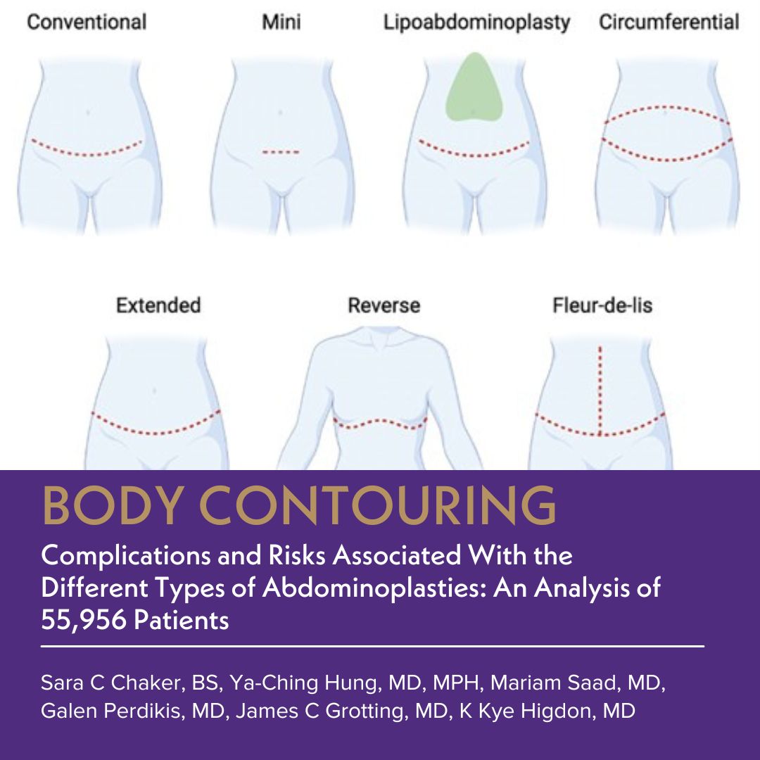 Aesthetic Surgery Journal/ASJ Open Forum (@asjrnl) on Twitter photo The aim of this study was to evaluate the complication rates and risks associated with each type of abdominoplasty.
🔗Read the paper: doi.org/10.1093/asj/sj…
<a href="/jcgrotting/">James C. Grotting</a> <a href="/DrKyeHigdon/">Higdon Plastic Surgery</a> <a href="/GalenPerdikis/">Galen Perdikis, M.D.</a> <a href="/drkenkel/">Jeffrey Kenkel, MD</a> @phaedracress <a href="/drgraemeglass/">Graeme E. Glass</a> <a href="/KristiHustakMD/">Dr. Kristi Hustak</a> <a href="/AngelaChengMD/">Angela Cheng</a> <a href="/drroykim/">Roy Kim 🇺🇸</a> The aim of this study was to evaluate the complication rates and risks associated with each type of abdominoplasty.
🔗Read the paper: doi.org/10.1093/asj/sj…
<a href="/jcgrotting/">James C. Grotting</a> <a href="/DrKyeHigdon/">Higdon Plastic Surgery</a> <a href="/GalenPerdikis/">Galen Perdikis, M.D.</a> <a href="/drkenkel/">Jeffrey Kenkel, MD</a> @phaedracress <a href="/drgraemeglass/">Graeme E. Glass</a> <a href="/KristiHustakMD/">Dr. Kristi Hustak</a> <a href="/AngelaChengMD/">Angela Cheng</a> <a href="/drroykim/">Roy Kim 🇺🇸</a>