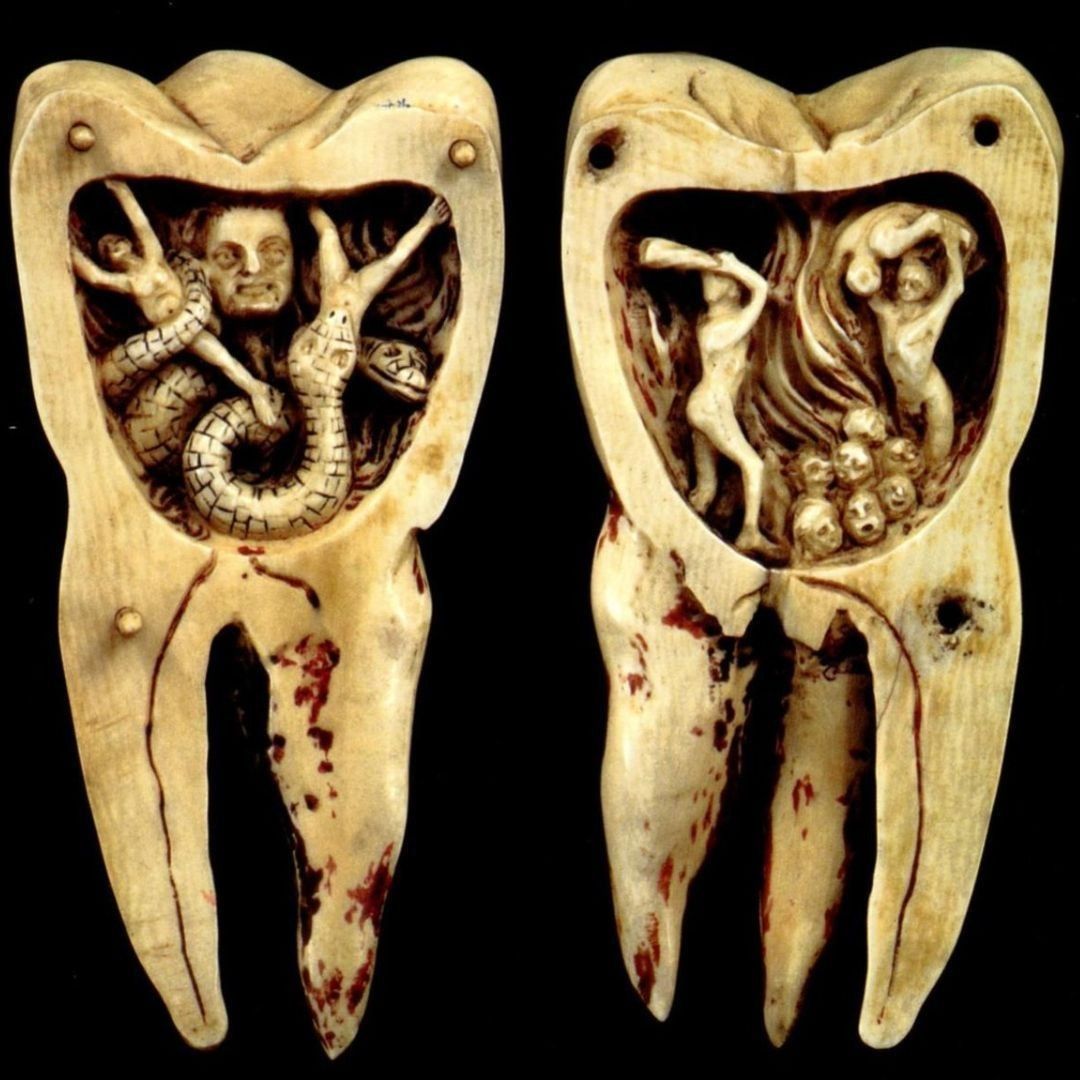 People used to believe that cavities were caused by demons boring holes in teeth.⁠