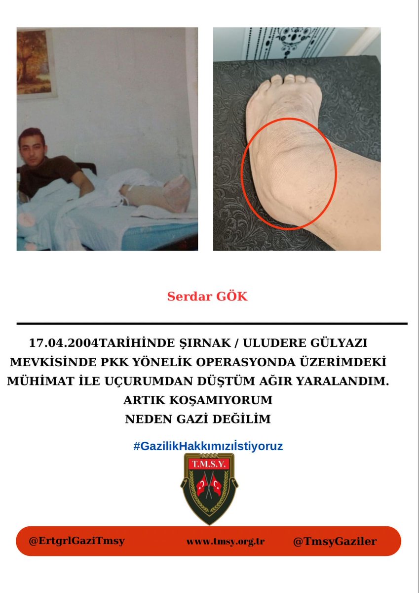 Sayın vekilim <a href="/cuneytyuksel_/">Prof. Dr. Cüneyt Yüksel</a> 
👇👇
KURŞUN YEDİK
ŞARAPNEL YEDİK
NİYE GAZİ DEĞİLİZ
👇
#GazilikHakkımızıİstiyoruz
☝️
<a href="/RTErdogan/">Recep Tayyip Erdoğan</a>
<a href="/_cevdetyilmaz/">Cevdet Yılmaz</a>
<a href="/MahinurOzdemir/">Mahinur Özdemir Göktaş</a>
<a href="/drbetulsayan/">Dr.Betül Sayan Kaya 🇹🇷</a> 
<a href="/hulusiakarmedya/">Hulusi AKAR</a> 
<a href="/refik_ozen16/">refik ozen</a> 
<a href="/FeyziBerdibek1/">Feyzi Berdibek🇹🇷</a>
<a href="/AhmetAYDIN_02/">Ahmet AYDIN</a>
<a href="/SayimMadak/">Dr. Sevim Sayım Madak 🇹🇷</a>
<a href="/leventalyyildiz/">Levent Ali YILDIZ</a> <a href="/mhrmkurt/">Muharrem KURT</a>