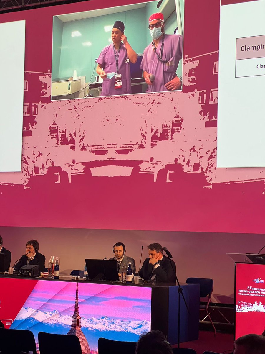 Savio Domenico Pandolfo (@pandolfosd) on Twitter photo Final surgery of the day at <a href="/TechnoUro/">13th Techno-Urology Meeting (TUM)</a>!
Congrats to <a href="/wuzhenjie17/">Zhenjie Wu, MD, PhD</a> for a superb retroperitoneal partial nephrectomy 👏
Big support from all <a href="/EAUYAU_RenalCa/">EAU-YAU Renal Cancer Working Group</a>, with top guidance from moderators <a href="/Ric_Campi/">Riccardo Campi</a> & <a href="/Nicp85Pavan/">Nicola Pavan</a>, and assistance from <a href="/RicBertolo/">𝙍𝙞𝙘𝙘𝙖𝙧𝙙𝙤 𝘽𝙚𝙧𝙩𝙤𝙡𝙤 MD PhD</a> 🤖 Final surgery of the day at <a href="/TechnoUro/">13th Techno-Urology Meeting (TUM)</a>!
Congrats to <a href="/wuzhenjie17/">Zhenjie Wu, MD, PhD</a> for a superb retroperitoneal partial nephrectomy 👏
Big support from all <a href="/EAUYAU_RenalCa/">EAU-YAU Renal Cancer Working Group</a>, with top guidance from moderators <a href="/Ric_Campi/">Riccardo Campi</a> & <a href="/Nicp85Pavan/">Nicola Pavan</a>, and assistance from <a href="/RicBertolo/">𝙍𝙞𝙘𝙘𝙖𝙧𝙙𝙤 𝘽𝙚𝙧𝙩𝙤𝙡𝙤 MD PhD</a> 🤖
