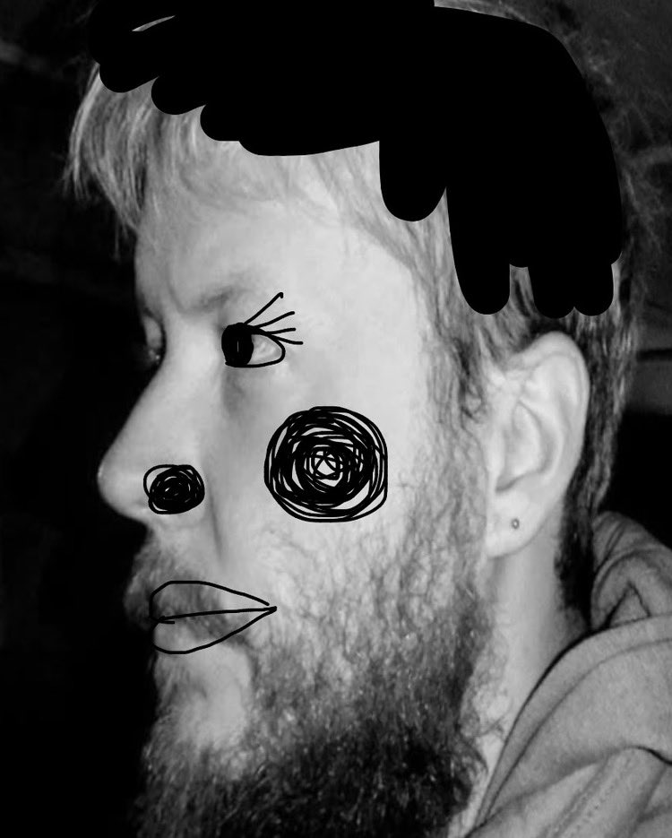 fatmanfluu's tweet photo. @deathink @S1EEPYHOE @deathink_art hyperpigmentation https://t.co/YJO5KEdTQB