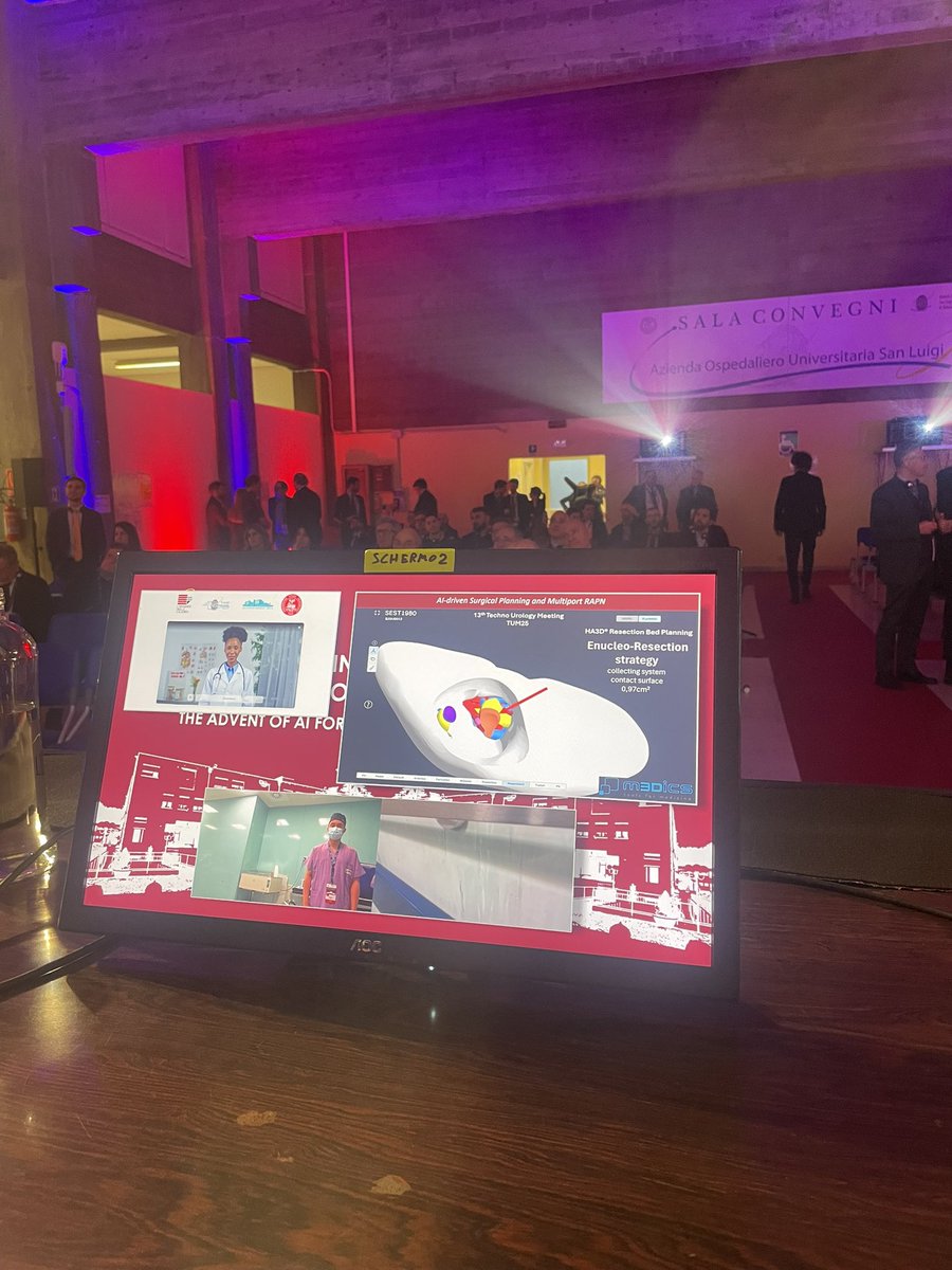 Riccardo Campi (@ric_campi) on Twitter photo <a href="/wuzhenjie17/">Zhenjie Wu, MD, PhD</a> <a href="/TechnoUro/">13th Techno-Urology Meeting (TUM)</a> <a href="/PorpigliaF/">Porpiglia Francesco</a> <a href="/EAUYAU_RenalCa/">EAU-YAU Renal Cancer Working Group</a> <a href="/danieleamparore/">Daniele Amparore</a> <a href="/EnricoCheccucci/">Enrico Checcucci</a> <a href="/Nicp85Pavan/">Nicola Pavan</a> <a href="/RicBertolo/">๐๐๐๐๐๐ง๐๐ค ๐ฝ๐๐ง๐ฉ๐ค๐ก๐ค MD PhD</a> <a href="/PandolfoSD/">Savio Domenico Pandolfo</a> Great job <a href="/wuzhenjie17/">Zhenjie Wu, MD, PhD</a> ! ๐๐ป๐๐ป๐๐ป <a href="/wuzhenjie17/">Zhenjie Wu, MD, PhD</a> <a href="/TechnoUro/">13th Techno-Urology Meeting (TUM)</a> <a href="/PorpigliaF/">Porpiglia Francesco</a> <a href="/EAUYAU_RenalCa/">EAU-YAU Renal Cancer Working Group</a> <a href="/danieleamparore/">Daniele Amparore</a> <a href="/EnricoCheccucci/">Enrico Checcucci</a> <a href="/Nicp85Pavan/">Nicola Pavan</a> <a href="/RicBertolo/">๐๐๐๐๐๐ง๐๐ค ๐ฝ๐๐ง๐ฉ๐ค๐ก๐ค MD PhD</a> <a href="/PandolfoSD/">Savio Domenico Pandolfo</a> Great job <a href="/wuzhenjie17/">Zhenjie Wu, MD, PhD</a> ! ๐๐ป๐๐ป๐๐ป