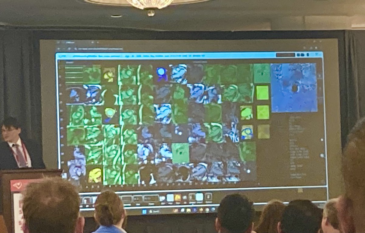 Manish Motwani (@doc_tiger) on Twitter photo Did u look at ALL the images? Green for yes; nice feature from <a href="/MycardiumAI/">MyCardium AI</a> - also “we’ve analysed 80 scans during this 10 min talk” #whyCMR #SCMR2025 Did u look at ALL the images? Green for yes; nice feature from <a href="/MycardiumAI/">MyCardium AI</a> - also “we’ve analysed 80 scans during this 10 min talk” #whyCMR #SCMR2025