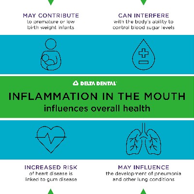 Did you know that #Inflammation in your mouth can have more serious side effects than just some discomfort? In fact, it can have a pretty big influence on your #OverallHealth, too. Learn more. 👇