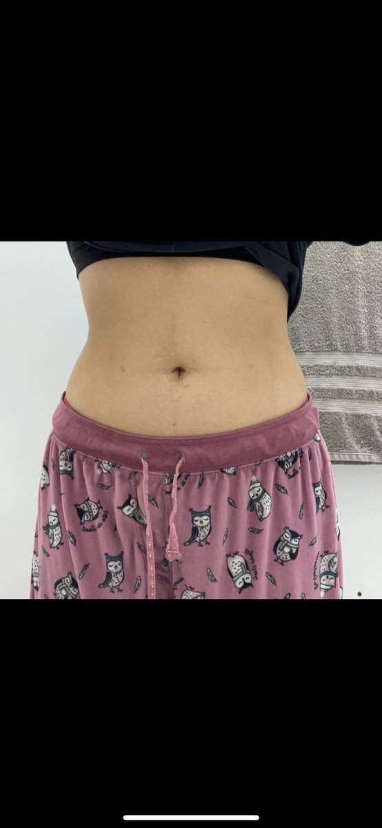 ellitarcat's tweet photo. dia 6 de setembro/ dia 30 de janeiro, nn achei que teve muita diferença🙁🙁🙁 https://t.co/jg4cVdlWX0