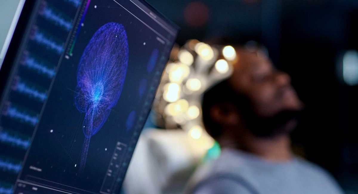 Global Brain Health Institute (@gbhi_fellows) on Twitter photo 🧠💤 Delayed REM sleep may be an early sign of #Alzheimers, disrupting memory and emotion regulation.
Atlantic Fellow <a href="/YueLengsleep/">Yue Leng</a> explores this link in a new study. Read more 👉 ucsf.edu/news/2025/01/4…
<a href="/UCSF/">UC San Francisco</a> <a href="/atlanticfellows/">Atlantic Fellows</a> 🧠💤 Delayed REM sleep may be an early sign of #Alzheimers, disrupting memory and emotion regulation.
Atlantic Fellow <a href="/YueLengsleep/">Yue Leng</a> explores this link in a new study. Read more 👉 ucsf.edu/news/2025/01/4…
<a href="/UCSF/">UC San Francisco</a> <a href="/atlanticfellows/">Atlantic Fellows</a>
