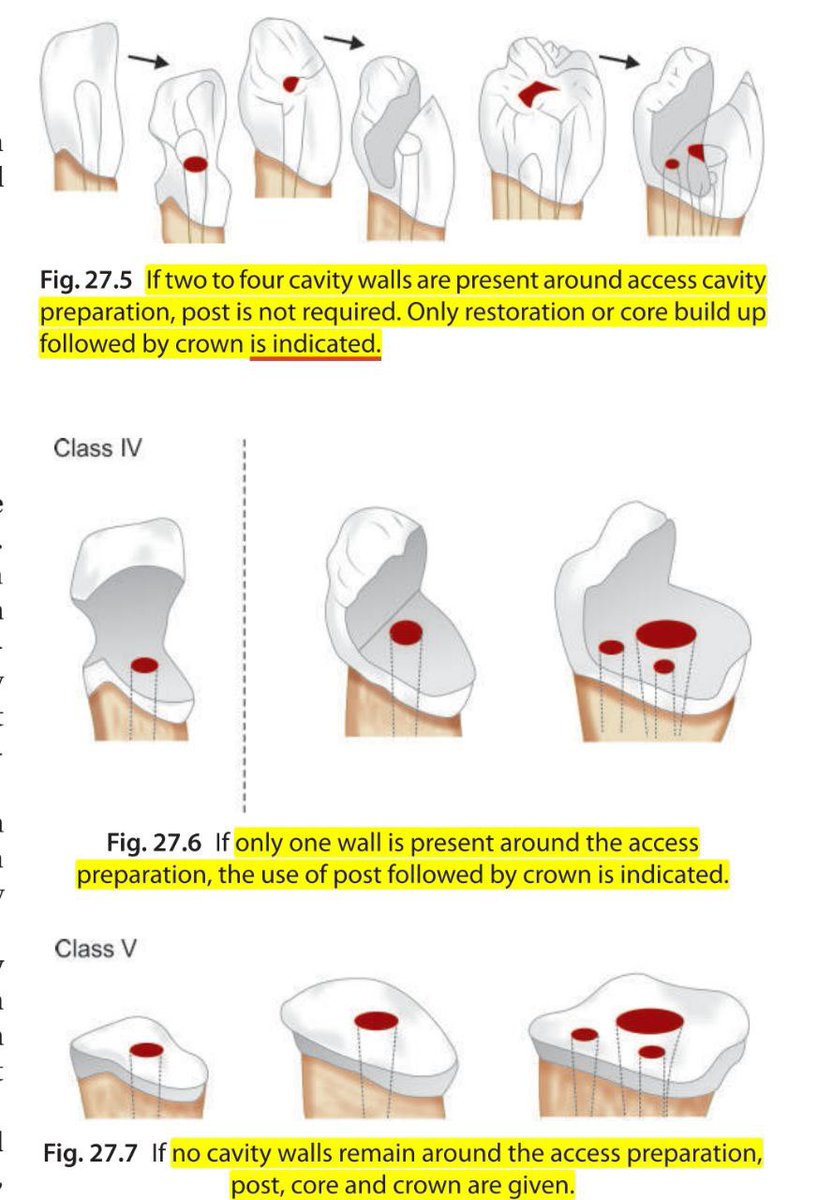 aboutDent's tweet photo. When you should use post ? 
👇🏻👇🏻 https://t.co/jqeDudnnMW
