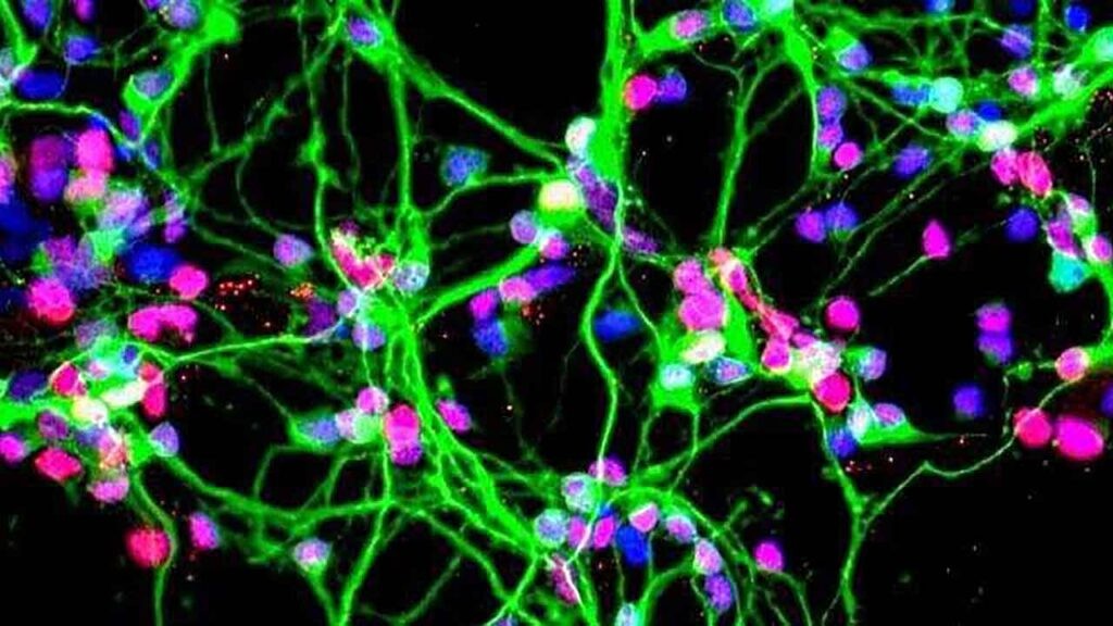 ISS National Lab (@iss_casis) on Twitter photo What happens to human brain cells when grown in space? #Sciencefiction? No! It’s a real, exciting area of research.
Innovative science from the <a href="/nationalscf/">National Stem Cell Foundation (NSCF)</a>, <a href="/scrippsresearch/">Scripps Research</a> & <a href="/nyscf/">New York Stem Cell Foundation Research Institute</a> is bringing hope to those suffering with #neurodegenerative diseases: ow.ly/g9Xt50UQcHz What happens to human brain cells when grown in space? #Sciencefiction? No! It’s a real, exciting area of research.
Innovative science from the <a href="/nationalscf/">National Stem Cell Foundation (NSCF)</a>, <a href="/scrippsresearch/">Scripps Research</a> & <a href="/nyscf/">New York Stem Cell Foundation Research Institute</a> is bringing hope to those suffering with #neurodegenerative diseases: ow.ly/g9Xt50UQcHz