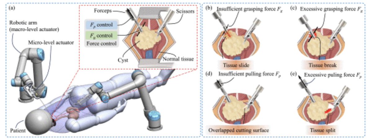 IeeeTro's tweet image. Utilizing innovative miniature sensorized forceps, a recent T-RO paper introduces a novel method to control multiple forces and automate tissue traction.
ieeexplore.ieee.org/document/10734…
#SurgicalRobots #AutomaticTissueTraction #RobotSensingSystems #MinimallyInvasiveSurgery @UNSW