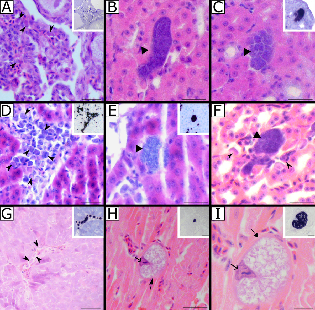 𝗡𝗲𝘄 𝗽𝗮𝗽𝗲𝗿 𝗶𝗻 𝗽𝗿𝗲𝘀𝘀 𝗶𝗻 𝗣𝗔𝗥𝗔𝗦𝗜𝗧𝗘:
Leucocytozoon infections in tits (Aves, Paridae): blood and tissue stages investigated using an integrative approach
🔜 parasite-journal.org 
Abstract: Leucocytozoon species are cosmopolitan and prevalent avian