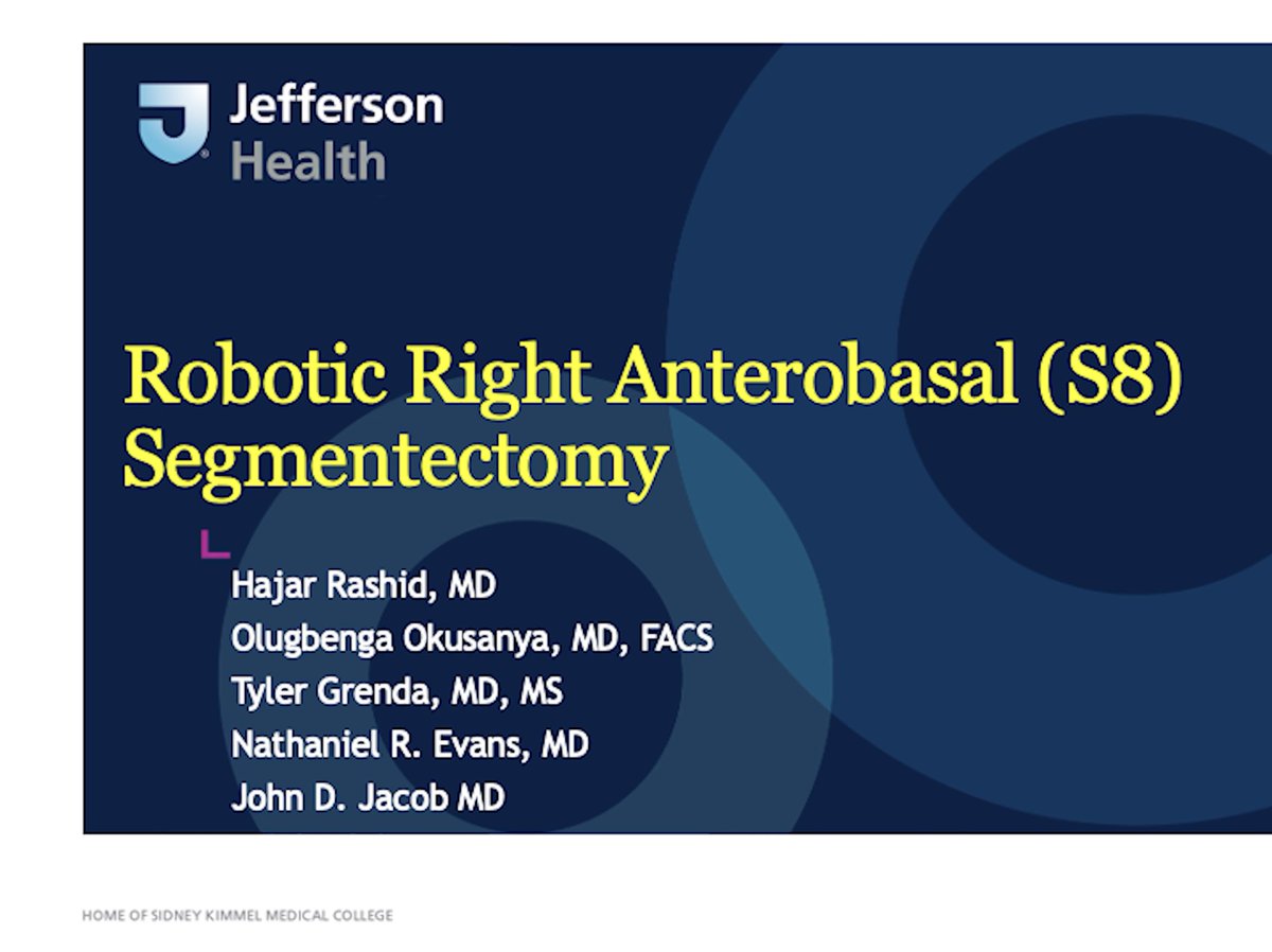 John D. Jacob, MD (@jdjmd) on Twitter photo Great video from our general surgery resident
<a href="/HajarJRashid/">Hajar J. Rashid, MD</a> Hajar Rashid
Robotic Right Anterobasal (S8) Segmentectomy youtu.be/XB97mQn43O4?si⦠via <a href="/YouTube/">YouTube</a>
<a href="/okusanyamd/">Olugbenga Okusanya MD</a> <a href="/tygrenda/">Tyler Grenda</a> <a href="/NateEvansMD/">Nathaniel R. Evans III, MD</a> <a href="/ctsnetorg/">CTSNet</a> Great video from our general surgery resident
<a href="/HajarJRashid/">Hajar J. Rashid, MD</a> Hajar Rashid
Robotic Right Anterobasal (S8) Segmentectomy youtu.be/XB97mQn43O4?si⦠via <a href="/YouTube/">YouTube</a>
<a href="/okusanyamd/">Olugbenga Okusanya MD</a> <a href="/tygrenda/">Tyler Grenda</a> <a href="/NateEvansMD/">Nathaniel R. Evans III, MD</a> <a href="/ctsnetorg/">CTSNet</a>