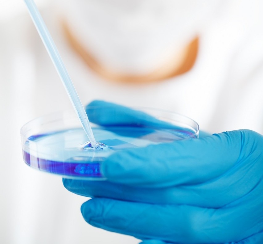 Hematopoiesis News (@hema_news) on Twitter photo Don't miss this new <a href="/CellDiscovery/">Cell Discovery</a> release! 📣
Findings suggested that placental hemogenic endothelial cells possess the potential to transform into self-renewing induced #HSPCs through retinoic acid treatment.
🔎 Discover more: go.nature.com/3WEEGTI Don't miss this new <a href="/CellDiscovery/">Cell Discovery</a> release! 📣
Findings suggested that placental hemogenic endothelial cells possess the potential to transform into self-renewing induced #HSPCs through retinoic acid treatment.
🔎 Discover more: go.nature.com/3WEEGTI