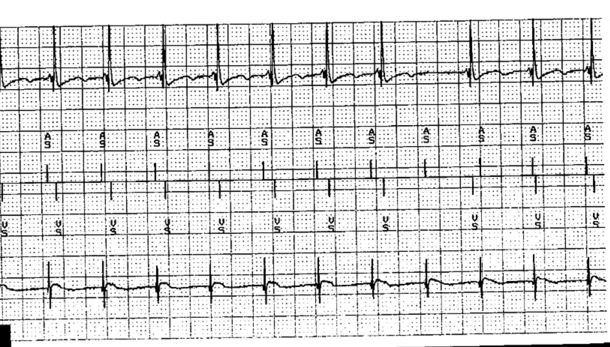 EPeeps101's tweet photo. #Epeeps101
#EPeeps 

#egm 
Level: #Intermediate ⭐️⭐️

How do you interpret this device interrogation? https://t.co/6zsctWXMhB