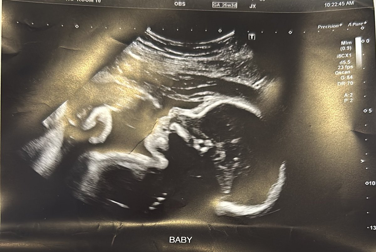 Kindie Exploration! tweet media