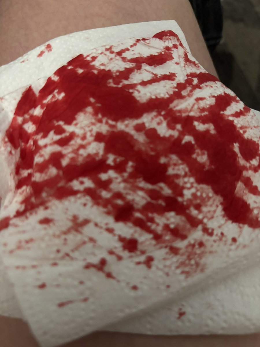 blended_skvllzz's tweet photo. #relaspe #shtwt relapse bc my mom pissed me off
TRIGGER WARNING https://t.co/AxIISMRBRQ