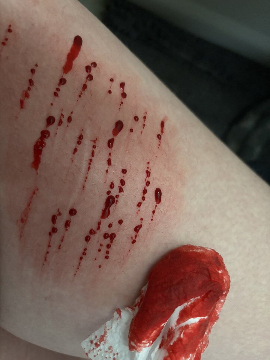 blended_skvllzz's tweet photo. #relaspe #shtwt relapse bc my mom pissed me off
TRIGGER WARNING https://t.co/AxIISMRBRQ