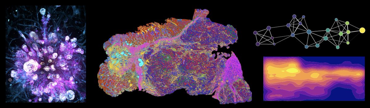 Gray Camp (@graycamplab) on Twitter photo We are searching for a Master's Student/Intern to join the group for 6-12 months to work on large-scale bioimage analysis of complex human model system data!
Please send your CV to: deco_ihb@roche.com #IHB We are searching for a Master's Student/Intern to join the group for 6-12 months to work on large-scale bioimage analysis of complex human model system data!
Please send your CV to: deco_ihb@roche.com #IHB