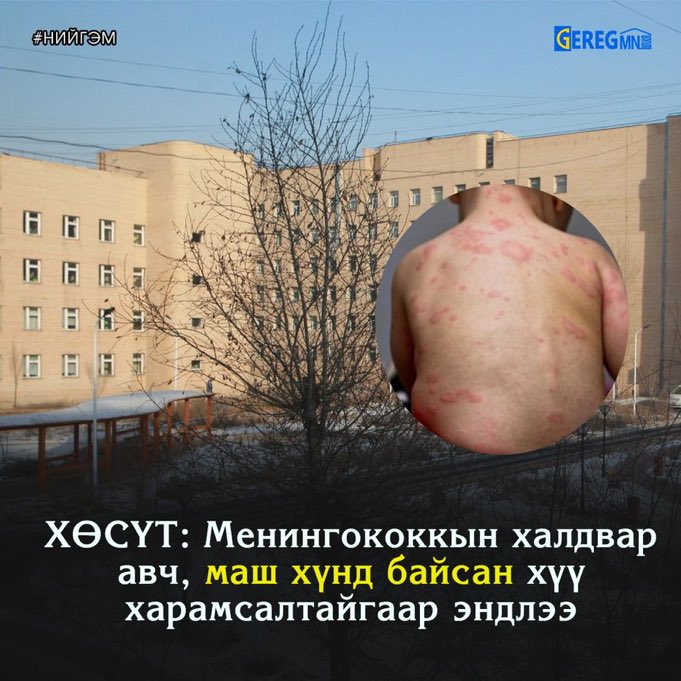 Вакцинаа хийлгэсэн бол тусахгүй л. Вакцин бол хор гэж тоть шиг цуурдаг хэд өөрсдөө мөрөөрөө үхэхгүй, бусдад гай чирсэн нь энэ. 🥲
Тэр Занаа мэтийн блаавгай нараас ам асуух ёстой шүү.