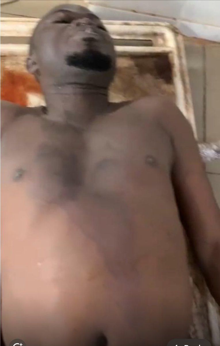 Wizarab10's tweet photo. A man, Fidelis Osaghae, was murdered last year at his workplace in Auchi, and his suspected killer, Valentine Oyemike who happens to be his employer, is being protected by the police in Auchi. There had been much effort put into protecting the suspect, Oyemike Valentine Nneoma, the owner of Valchi hotel, than investigating the cause of death.

Circumstances of the deceased's death are very suspicious. The deceased returned from work at 2:30am and told his wife that he had to return to work because his boss asked him to bring something. But that would be the last time she saw her husband. At 5am, Esther Osaghae, the distressed wife of the deceased, began calling her husband but was unable to reach him. She then placed a call to his colleague Tracey, who happens to be a supervisor at the facility, but she kept assuring the wife that everything was under control and cut the call on the wife. At about 6am, the deceased's  wife received a call from Oyemike Valentine, the deceased’s boss, who told her to come to Favour Hospital, Afasho, Edo State.

Being a nursing mom with a suckling child, Esther Osaghae couldn't go, but her sister went in her place and met the dead body of the deceased. The hospital said he was dead on arrival. The news made the wife go identify the husband's body and on arrival, saw large black patch from chest to neck and dry blood stain on the chest of the deceased. His trouser was also torn.

Despite visible injury to the body of the deceased, the DPO of the Auchi division claimed the suspect, Oyemike Valentine told him that the deceased committed suicide by drinking sniper. How does a person who drank sniper have injuries to the body with torn clothes? Why would the boss carry the dead body to the hospital in his own car? Why should the DPO listen to only the version of the suspect to reach a conclusion? Even worse, the DPO accused the deceased's wife and her sister of murdering the deceased in a desperate cover up.

The father of the deceased was also frustrated by the DPO to let the case die by discouraging him from an autopsy even if he was willing to foot the bill. The DPO went ahead to show him the deceased's case file where he had already written the death as suicide. The handling of the matter by Auchi division is sinister, distrustful, and posits a miscarriage of justice. The lack of desire in the DPO to investigate the matter made the deceased's father to lose faith in Auchi division to handle the matter and prompted a petition to be written to the IG of Police by the @AFFoundationng and its founder @akinfadeyi1

********
Subject to the petition, the IG of Police sent a team of investigators to Auchi. However, there appears to be deliberate effort to pervert justice and tamper with the fact. The suspect is still walking free with no arrest made. The @AFFoundationng
@WRAPANG
@FIDANigeria are demanding for the investigation report.

Initial autopsy and toxicology report revealed asphyxiation as cause of death. But asphyxiation is a hazy and lazy conclusion. There are many causes of asphyxiation. A review of the report and expert opinion surrounding the circumstances of the death indicates strangulation and forced injection of toxic substance.

With engorged veins in the neck potentially caused by strangulation, and blunt force trauma to the head, how can the police  claim the cause of death is poison? Why was poison administered to his body to doctor the fact? Experts opinion is that the deceased was strangled to death and forcibly administered poisonous substance.

It is interesting to point out the inconsistencies in the first Autopsy and Toxicology report carried out by the police from the one conducted independently. The result of the independent report showed the deliberate attempt to cover up the cause of death in the first report. Please read the toxicology report and the petition to arrest and prosecute Valentine Oyemike.