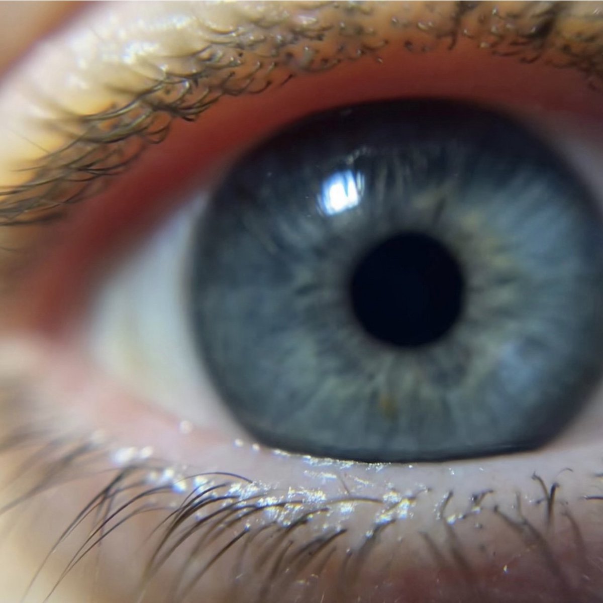 It’s important to keep up to date with routine eye exams. Regular exams not only keep your vision sharp but can also detect early signs of conditions like glaucoma, cataracts and diabetes. Don't wait until something feels wrong; make eye exams part of your health care routine.