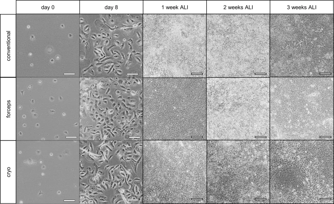 RespiratoryBMC's tweet photo. 📕Article Alert📕
Bronchoscopic biopsies - a novel source for primary airway epithelial cells in respiratory research 🫁🔬
#OpenAccess #EpithelialCell #RespiratoryResearch
Read the Article: https://t.co/aPbdsrLF9P https://t.co/MCIm7VM15u
