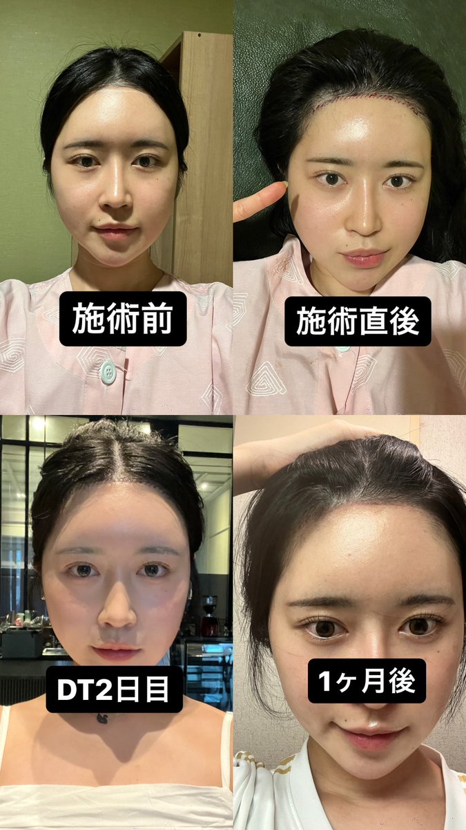 韓国DM美容外科 tweet media
