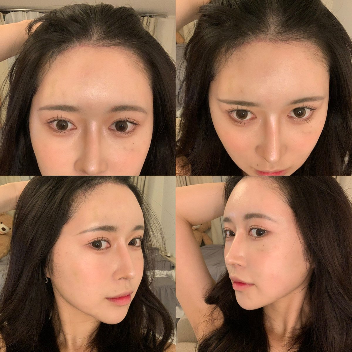 韓国DM美容外科 tweet media