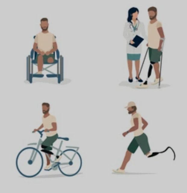 MrSpiritsRaven's tweet photo. For My #Disabled #Community
I have been a Right Below Knee Amputee 🦿 #RBKA For 6 Years.
Being a #RightBelowKneeAmputee comes with some #Advantages & some #Disadvantages, as with Any One who has a #Disability. I am no Different.
Those of us who have a Disability learn to Adapt. To Persevere. To Endure Daily Setbacks. But NEVER GIVE Up.
Notice I DIDN'T say we're DISABLED. We're Not.
We have a DISABILITY. We are in "No Way #Disabled."
When I became an #Amputee in 2019, January 31st to be exact, it was NOT a surprise or shock to Me. I had been diagnosed with #Osteomyelitis
Osteomyelitis is a bone infection & my right leg below the knee could not be SAVED.
This occurred because of a roadside IED during my military career decades earlier. I was involved in this IED explosion. I was the only one in this targeted caravan explosion who experienced an injury.
My "Injury" was a Pebble the size of a 5 carat diamond 💎 embedded in my calf 🦵🏿 of that right leg. Army Ranger ¿surgeons¿ decided it was not NECESSARY to go in & extract this pebble. It would have no future repercussions on my life.
That SURGEON was Very Very Mistaken.
Fast forward to 20 plus years later & this pebble had decided to become TOXIC & Infect my Leg.
Not a big deal. I have been/had been through a lot worse.
The Doctor said "amputate." I responded LET'S DO IT.
THAT'S MY BORING HISTORY OF HOW I BECAME AN AMPUTEE.
NOW On To The Reason For This POST.
To All The Amputees Or More Specifically to ALL THE PEOPLE WITH A DISABILITY: Your Future will CHANGE.
NOTHING will be the "Norm, Normal" any longer. Your Life CAN BE Just As Beautiful, Just As Fulfilling, Just As Bright & ENJOYABLE.
NOW I'M SPEAKING SPECIFICALLY TO THOSE WITH AN AMPUTATION BECAUSE THAT'S WHAT I KNOW BEST.
The FIRST step in recovery would be: Find A #Prosthetist who is Magnificent At Their Job.
A Prosthetist is a #HealthcareProvider who MAKES & Fits #ArtificialLimbs (#Prostheses) for People with Disabilities.
The key to #Mobility, having "Great Mobility" & Preventing Further Injury To Your Limb is This Magnificent Prosthetist.
The Second Step To Recovery is DON'T GIVE UP.
THERE ARE GOING TO BE QUITE A FEW DAYS WHERE YOU GET DISCOURAGED.
You GOING to have Days you wake up & don't feel like putting that #Prosthetic 🦾🦿on & Going About Your Day. You're going to be Tempted To Stay In Bed 🛏️.
NEVER DO THAT. Use these 🩼👨🏿🦽👨🏿🦼in the BEGINNING. Then put these 👨🏿🦼🩼👨🏿🦽ln The Closest!!
#Mobility is the End Game, the Result, the Mission, you want to ACCOMPLISH & ACHIEVE.
Mobility WON'T COME QUICK. IT WON'T COME FAST. MOST LIKELY IT WON'T BE EASY.
Just Don't Give Up Hope. Don't Give Up Working Towards Your Goal.
Don't STOP making Every Day an Improvement Over Yesterday.
If you have A DISABILITY. You need to TALK, YOU Need Advice. You Need A 🧔🏿♂️Cheerleader, DM Me.
Good Luck. You Can Do This. If I Did It You CAN DO IT.