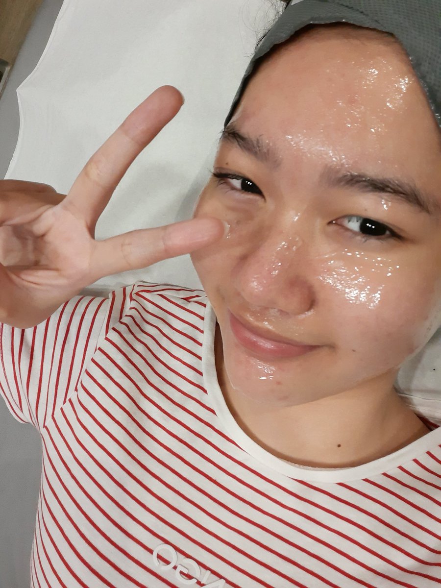 nigresi's tweet photo. me time versi aku salah satunya treatment si black carbon facial laser di @DermiesMax sambil ngobrol bareng staff yang ramah pol https://t.co/h3FscdJpFT