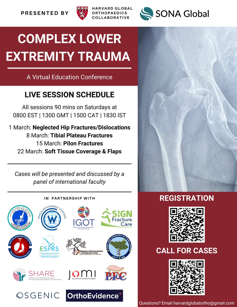 Kiran Agarwal-Harding (@kiranharding) on Twitter photo Our 2025 <a href="/OrthoGlobal/">Harvard Global Orthopaedics Collaborative</a> <a href="/SONAGlobalOrg/">SONA Global</a> conferences just launched! Our first live sessions are in March. Register: forms.gle/ArdSqyNiXiEGPP…. All surgeons are welcome to join.
<a href="/SIGNtweeter/">SIGN Fracture Care</a> <a href="/igotglobal/">IGOT</a> <a href="/Orthoconcern/">World Orthopaedic Concern UK</a> <a href="/SS_trauma/">South Sudan Orthopaedics and Trauma Society</a> <a href="/The_PSF/">The Plastic Surgery Foundation (The PSF)</a> <a href="/OrthoEvidence/">OrthoEvidence</a> <a href="/osgenic/">Osgenic</a> <a href="/ESOTethiopia/">Ethiopian Society of Orthopaedic and Traumatology</a> Our 2025 <a href="/OrthoGlobal/">Harvard Global Orthopaedics Collaborative</a> <a href="/SONAGlobalOrg/">SONA Global</a> conferences just launched! Our first live sessions are in March. Register: forms.gle/ArdSqyNiXiEGPP…. All surgeons are welcome to join.
<a href="/SIGNtweeter/">SIGN Fracture Care</a> <a href="/igotglobal/">IGOT</a> <a href="/Orthoconcern/">World Orthopaedic Concern UK</a> <a href="/SS_trauma/">South Sudan Orthopaedics and Trauma Society</a> <a href="/The_PSF/">The Plastic Surgery Foundation (The PSF)</a> <a href="/OrthoEvidence/">OrthoEvidence</a> <a href="/osgenic/">Osgenic</a> <a href="/ESOTethiopia/">Ethiopian Society of Orthopaedic and Traumatology</a>