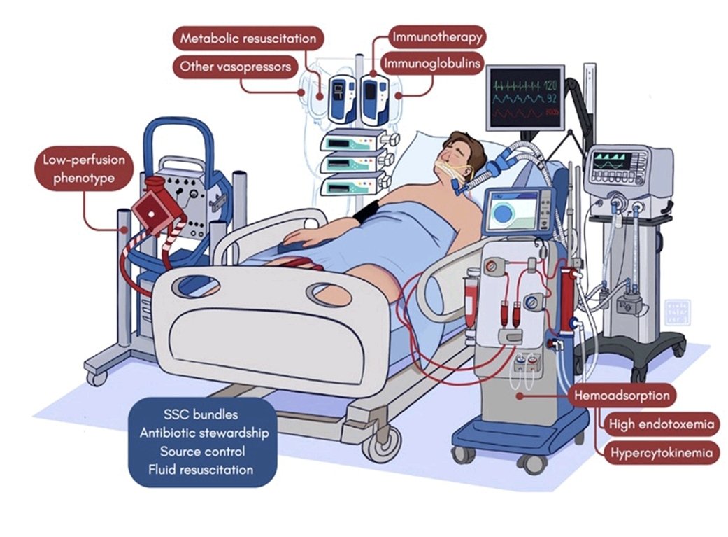 LeslieMegom's tweet photo. 📌Perspectivas actuales en el manejo de la sepsis y el choque séptico.🦠
▪️ La norepinefrina, un agonista adrenérgico fuerte, es el vasopresor estándar para tratar la hipotensión inducida por el choque séptico, pero los vasopresores adrenérgicos se han asociado con varios efectos perjudiciales, incluida la disfunción orgánica y el aumento de la mortalidad ☠️El sistema renina-angiotensina-aldosterona (RAAS) proporciona un importante mecanismo fisiológico para prevenir la hipotensión sistémica en condiciones hipovolémicas, como el choque séptico no resucitado. ▪️Además de su función hemodinámica clásica de regular la presión arterial, la angiotensina-II (AT-II) desempeña un papel clave en varios procesos biológicos, como el crecimiento celular, la apoptosis, la respuesta inflamatoria y la coagulación. También puede afectar a la función mitocondrial
Corticosteroides
▪️Los mediadores proinflamatorios en los sitios inflamados contrarrestan la respuesta antiinflamatoria, la hidrocortisona tuvo una resolución de choque más rápida y tuvieron una duración más corta del episodio inicial de ventilación mecánica. 
👇🏻👇🏻👇🏻👇🏻👇🏻
https://t.co/PUZKAR7rul
🔐
https://t.co/USEOnCuSxr
