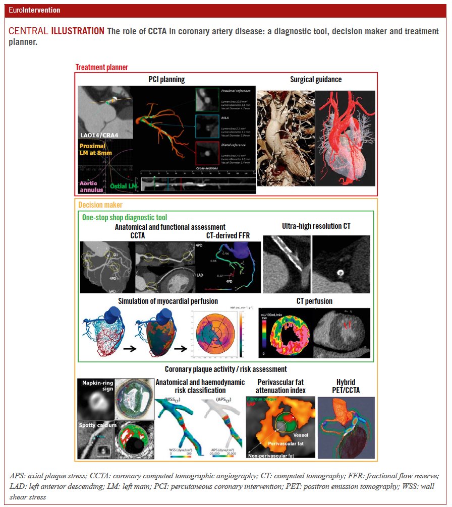 EuroIntervention (@eurointerventio) on Twitter photo Coronary CT angiography is playing an increasing role in the assessment of coronary artery disease, from plaque evaluation to PCI guidance. This review explored its potential as a comprehensive diagnostic tool. Read more: shorturl.at/TZrwj
<a href="/SerruysPatrick/">Serruys patrick</a> <a href="/OnumaYoshinobu/">Yoshinobu Onuma</a> Coronary CT angiography is playing an increasing role in the assessment of coronary artery disease, from plaque evaluation to PCI guidance. This review explored its potential as a comprehensive diagnostic tool. Read more: shorturl.at/TZrwj
<a href="/SerruysPatrick/">Serruys patrick</a> <a href="/OnumaYoshinobu/">Yoshinobu Onuma</a>
