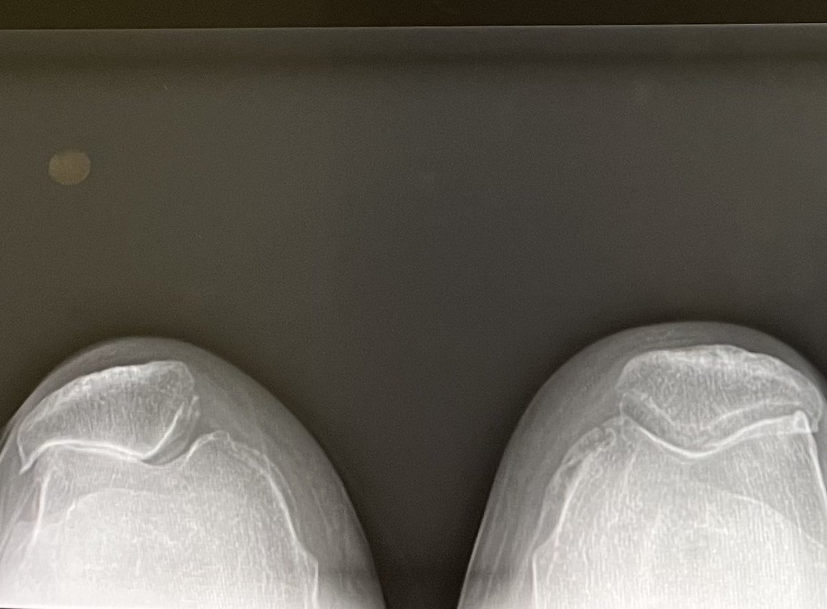 Patrick Morgan, MD, FAOA tweet media