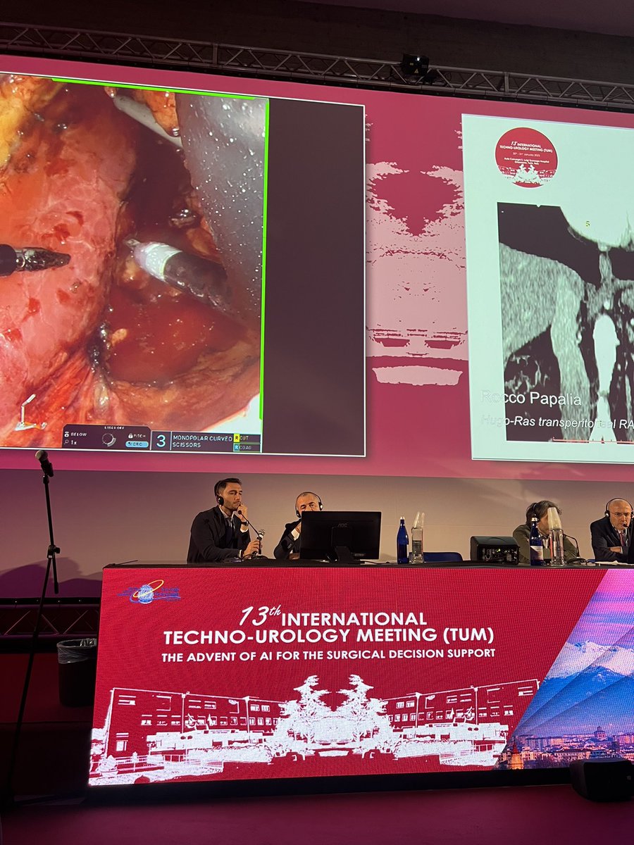 Savio Domenico Pandolfo (@pandolfosd) on Twitter photo Honored to have moderated the live surgery broadcast from <a href="/istitutotumori/">Istituto Nazionale Tumori Pascale</a> in Naples at <a href="/TechnoUro/">13th Techno-Urology Meeting (TUM)</a>
well-executed SR RAPN with an anterior approach by Sisto Perdonà
Congrats to the whole team! Honored to have moderated the live surgery broadcast from <a href="/istitutotumori/">Istituto Nazionale Tumori Pascale</a> in Naples at <a href="/TechnoUro/">13th Techno-Urology Meeting (TUM)</a>
well-executed SR RAPN with an anterior approach by Sisto Perdonà
Congrats to the whole team!