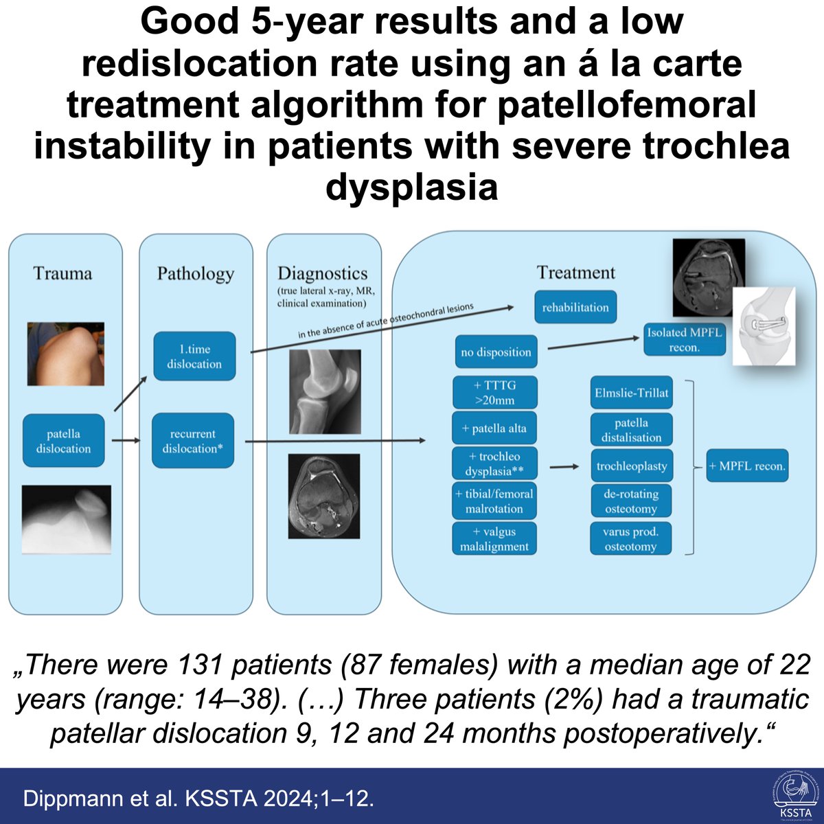 KSSTA's tweet photo. Patient-specific treatment of patellofemoral instability leads to a very low redislocation rate, according to this new KSSTA study. 
 
#knee #patellofemoral #trochlea #clinicalstudies #KSSTA
 
Read here: https://t.co/lRdSH9PR1N https://t.co/q4bhuF8p4a