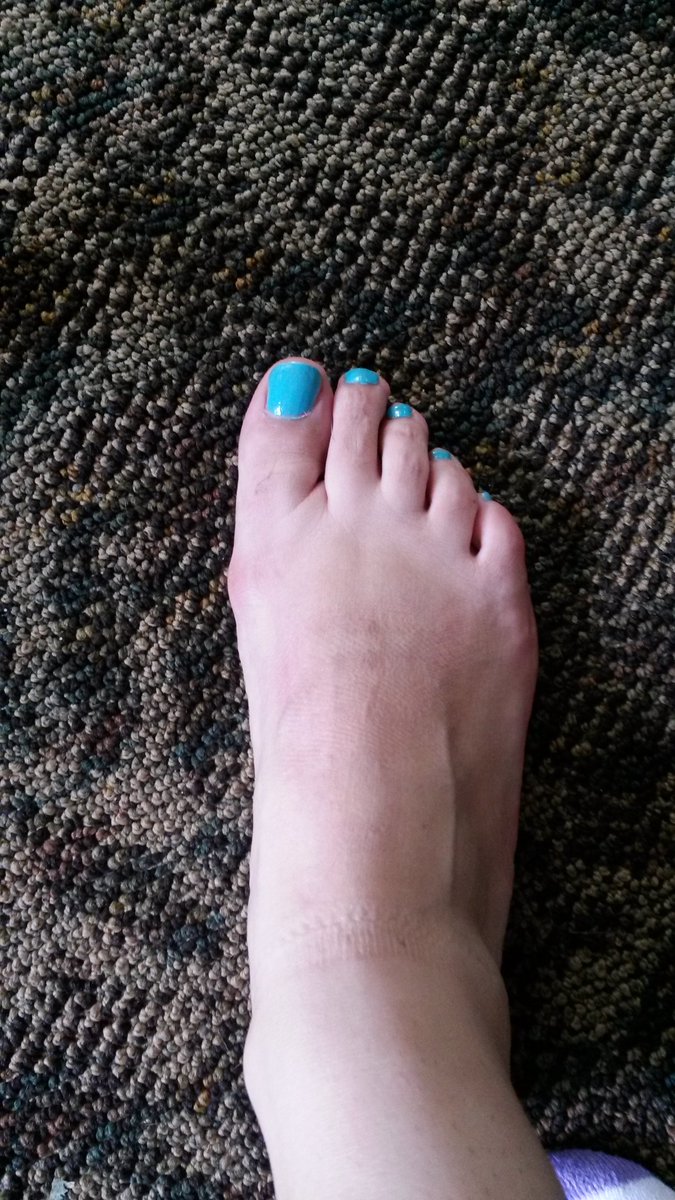 My lil redbone homie. She like to pop beans and her titties been big since we was kids. She let me catch a few shots every now and a again. Decent lil toes🤷🏾‍♂️