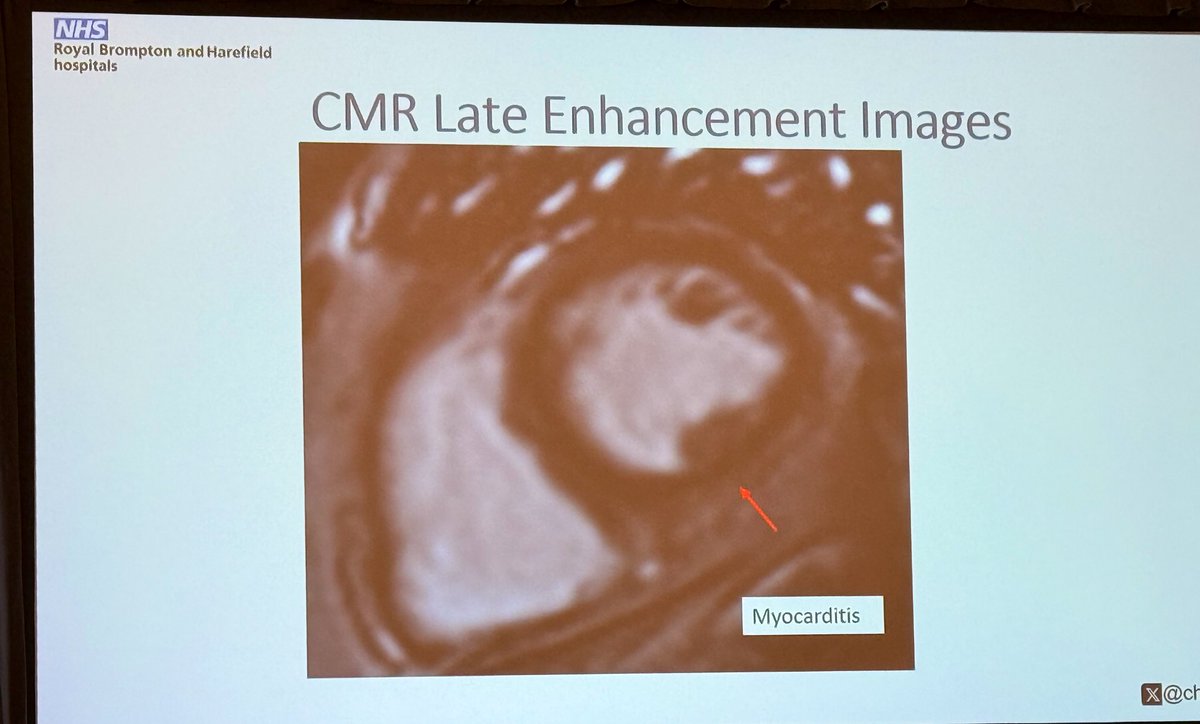 Ritu Thamman MD (@iamritu) on Twitter photo Microvascular D #SCMR2025
#Pet <a href="/NitiCardio/">Niti R. Aggarwal, MD, FSCMR, FASNC, FACC</a> 🆚 #WhyCMR <a href="/chiarabd/">C Bucciarelli-Ducci</a>
Pro #PET class 1 (B) in CP guidelines ,available widely can use w devices,implants
Pro #WhyCMR numbers/maps equal to PET & is more comprehensive w LGE & can clarify CP (myocarditis) , more cost effective w 1 test Microvascular D #SCMR2025
#Pet <a href="/NitiCardio/">Niti R. Aggarwal, MD, FSCMR, FASNC, FACC</a> 🆚 #WhyCMR <a href="/chiarabd/">C Bucciarelli-Ducci</a>
Pro #PET class 1 (B) in CP guidelines ,available widely can use w devices,implants
Pro #WhyCMR numbers/maps equal to PET & is more comprehensive w LGE & can clarify CP (myocarditis) , more cost effective w 1 test
