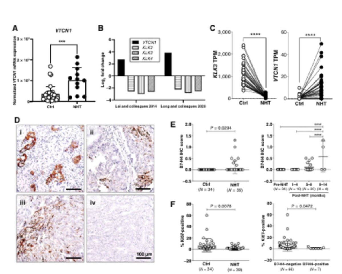 Molecular Cancer Research (@mcr_aacr) on Twitter photo Exploring B7-H4ās role in #ProstateCancer dormancy post-androgen deprivation therapy: extracellular matrix interactions and therapeutic opportunities brnw.ch/21wQnZ5
<a href="/HtooZOo/">Htoo Zarni Oo</a> <a href="/madsdaug1/">Daugaard Laboratory</a> <a href="/yuzhuo_wang/">yuzhuo wang</a> <a href="/BCCancer/">BC Cancer</a> <a href="/VanProstateCtr/">Vancouver Prostate Centre</a> <a href="/UBC/">University of British Columbia</a> <a href="/genome_me/">GenomeMe Labs Inc.</a> Exploring B7-H4ās role in #ProstateCancer dormancy post-androgen deprivation therapy: extracellular matrix interactions and therapeutic opportunities brnw.ch/21wQnZ5
<a href="/HtooZOo/">Htoo Zarni Oo</a> <a href="/madsdaug1/">Daugaard Laboratory</a> <a href="/yuzhuo_wang/">yuzhuo wang</a> <a href="/BCCancer/">BC Cancer</a> <a href="/VanProstateCtr/">Vancouver Prostate Centre</a> <a href="/UBC/">University of British Columbia</a> <a href="/genome_me/">GenomeMe Labs Inc.</a>