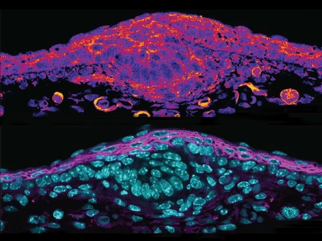 Biomedical Picture of the Day BPoD (@bpod_s) on Twitter photo Mechanical forces underlying cell, tissue & organ shaping informed by hair follicle formation
📷<a href="/Clem_Villeneuve/">Clementine Villeneuve</a> et al <a href="/helsinkiuni/">University of Helsinki</a> <a href="/MPI_Muenster/">MPI Molecular Biomedicine</a>
<a href="/WickstromLab/">Wickstrom-Lab</a> <a href="/ManningResearch/">M. Lisa Manning</a> <a href="/SyracuseU/">Syracuse University</a>
in <a href="/NatureCellBio/">Nature Cell Biology</a>
➡️ bpod.org.uk/archive/2025/1… with <a href="/AntDLewis/">Ant Lewis</a> Mechanical forces underlying cell, tissue & organ shaping informed by hair follicle formation
📷<a href="/Clem_Villeneuve/">Clementine Villeneuve</a> et al <a href="/helsinkiuni/">University of Helsinki</a> <a href="/MPI_Muenster/">MPI Molecular Biomedicine</a>
<a href="/WickstromLab/">Wickstrom-Lab</a> <a href="/ManningResearch/">M. Lisa Manning</a> <a href="/SyracuseU/">Syracuse University</a>
in <a href="/NatureCellBio/">Nature Cell Biology</a>
➡️ bpod.org.uk/archive/2025/1… with <a href="/AntDLewis/">Ant Lewis</a>