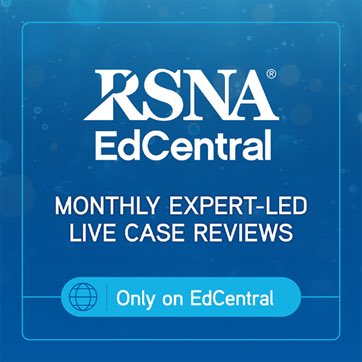 Únase a nuestros profesores expertos mientras analizan casos interesantes (15 mins), disponibles exclusivamente en EdCentral - 4:00 p. m. CT, martes cada 2 meses. Para registrarse, visite el canal “On the Case” y busque la SmartCard correspondiente. rsna.edcast.com/insights/revis…