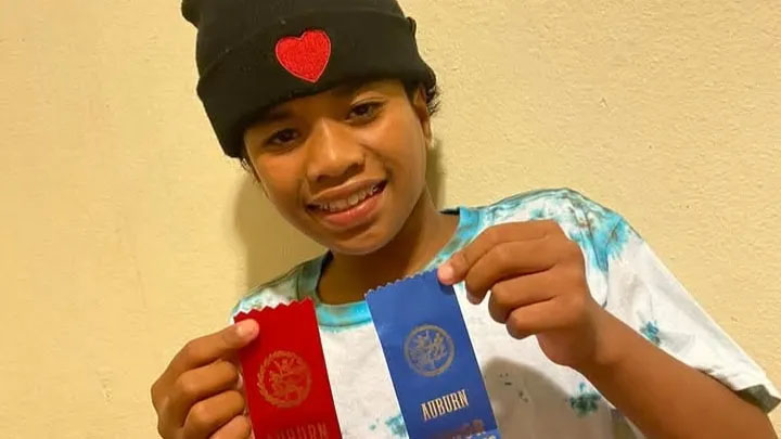 MyEverettNews's tweet photo. Everett Stabbing Victim Speaks Up: https://t.co/ybgeZPd9M3 #everettwa #stabbing #unprovokedattack https://t.co/gW5dGXlXUR