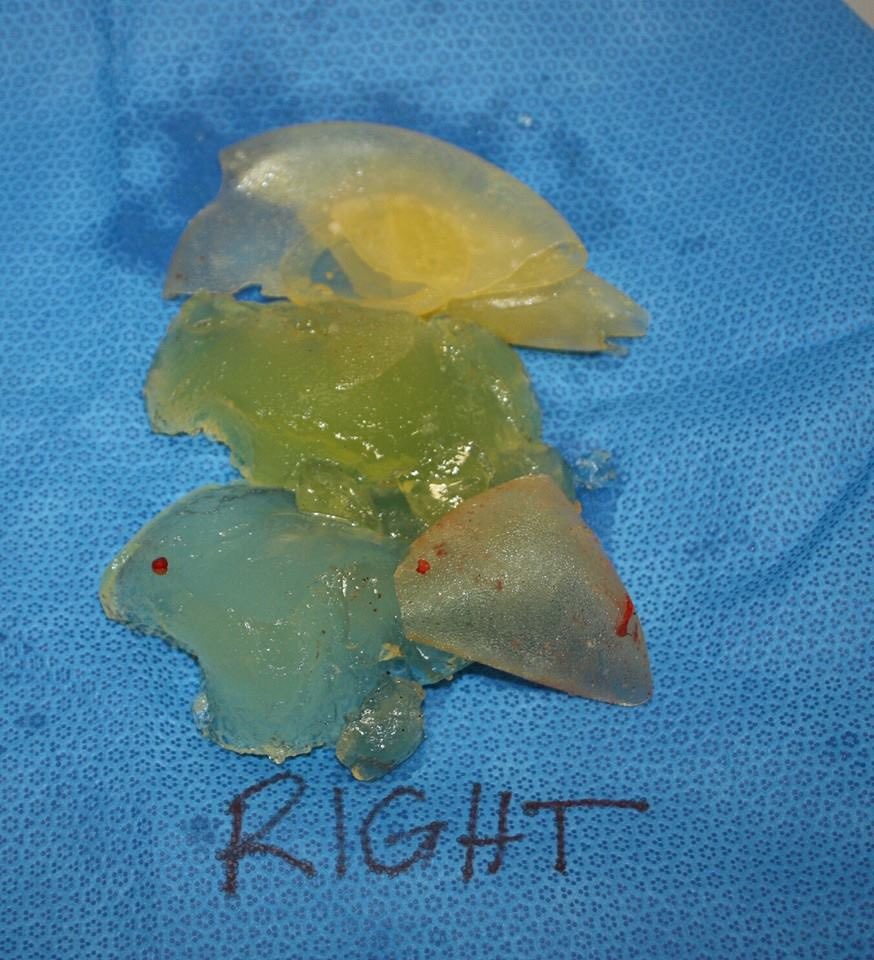 No evidence of harm in #PIP #breastimplant fraud involving 47,000 UKwomen, why not <a href="/DHSCgovuk/">Department of Health and Social Care</a> <a href="/MHRAgovuk/">MHRAgovuk</a> <a href="/DrBruceKeogh/">Bruce Keogh</a> ? #ScientificDishonesty #scientificFRAUD <a href="/wesstreeting/">Wes Streeting</a> <a href="/PutneyFleur/">Fleur Anderson MP</a> <a href="/PSCommissioner/">Patient Safety Commissioner</a> <a href="/Keir_Starmer/">Keir Starmer</a> <a href="/DanCardenMP/">Dan Carden</a> <a href="/YasminQureshiMP/">Yasmin Qureshi MP</a> <a href="/RupertLowe10/">Rupert Lowe MP</a> #HILLSBOROUGHlaw